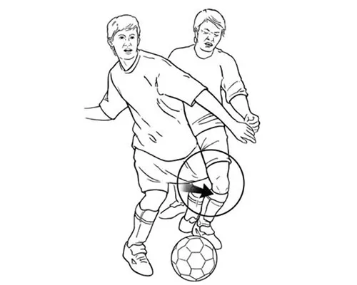 Other Ligament Injury – illustration 4
