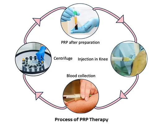 Biological Treatment